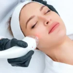 How to Take Care of My Skin After Laser Hair Removal?